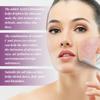 20% Niacinamide B3 Concentrated Skincare Anti Aging Color Removal Pore  Shrinking Spot Fading Wrinkles and Wrinkles 20ml
