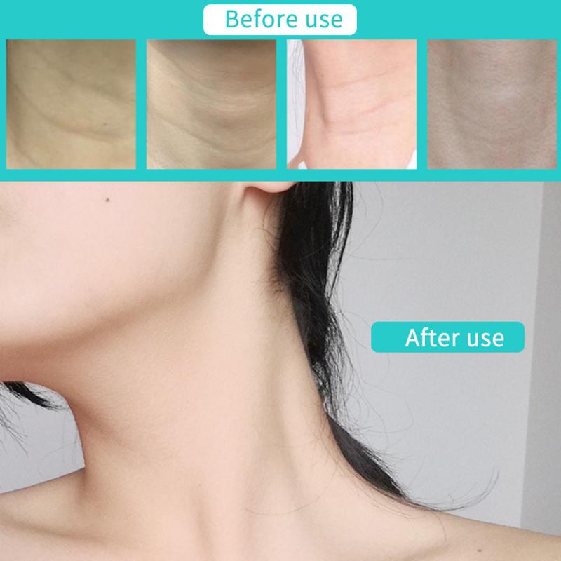 Invisible Neck Lifting Bandage – Anti-Wrinkle V-Shaped Facial Adhesive Tape for Skin Tightening and Double Chin Reduction