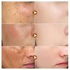 Dark Spots Remover Whitening Serum Face Freckle Melanin Correcting Reduce Fine Lines Brighten Essence Korean Beauty Skin Care