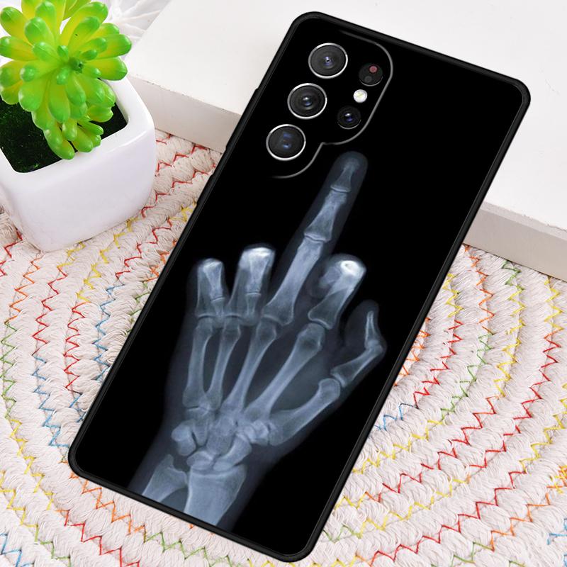 X-Ray Human Anatomy TPU Phone Case For Samsung Galaxy Note 10 Pro S26 S25 S24 S23 S22 Ultra Plus S21 FE S20 Shockproof Cover