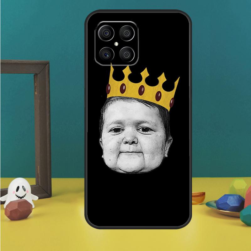 Funny Hasbulla Case For Honor X9c X8a X8b X9b X9a X8 X9 50 70 90 Lite Honor 200 Pro Magic 5 6 7 Lire Cover