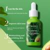 Avocat Complete 30 fois Vitamine C Nicotinamide Enhanced Essence Facial Repair Essence Acne Remover Beauty Product Face Care