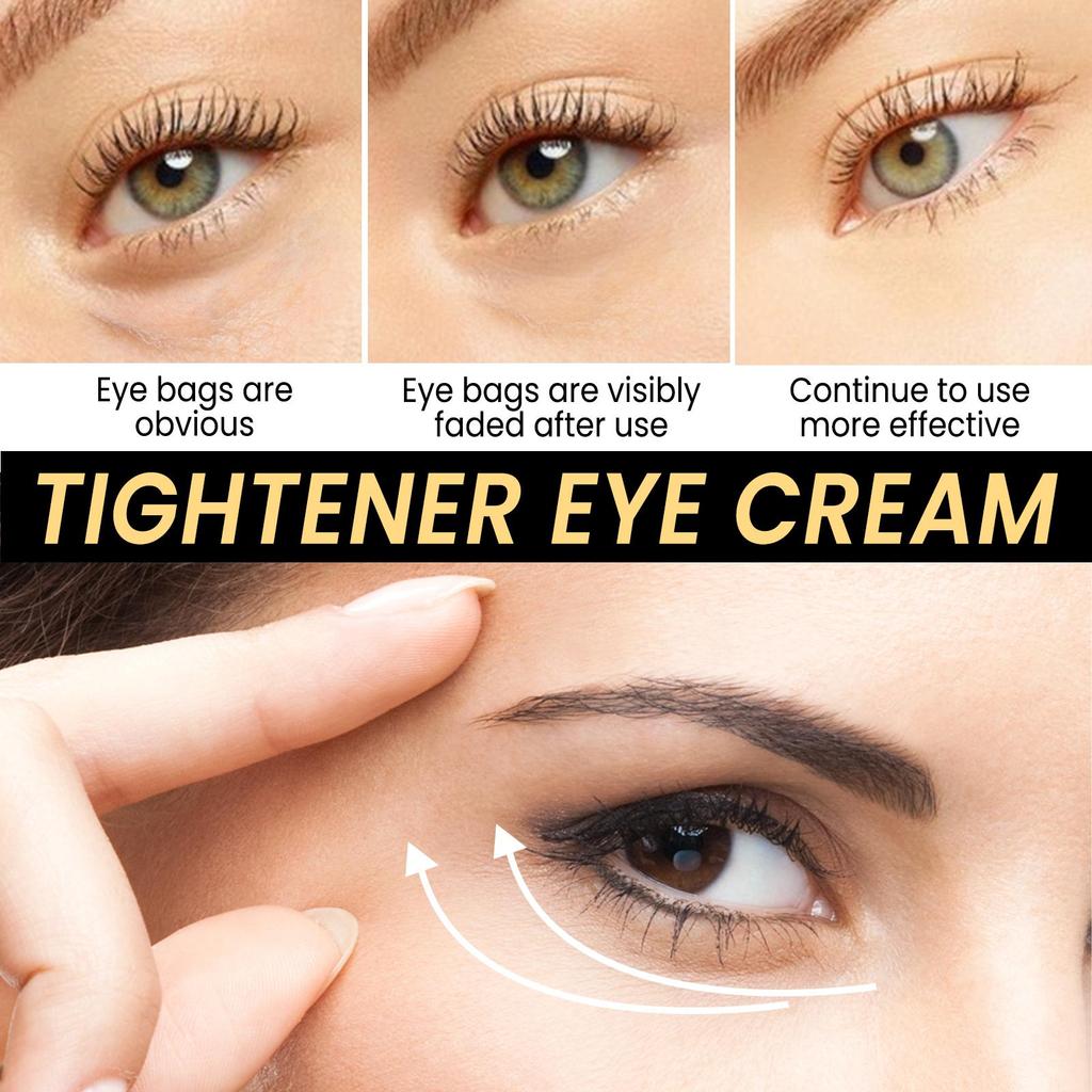 Jaysuing Eye Cream Gently Nourishes and Reduces Fine Lines, Bounces, Plumps and Moisturizes the Skin Around the Eyes Daily Care