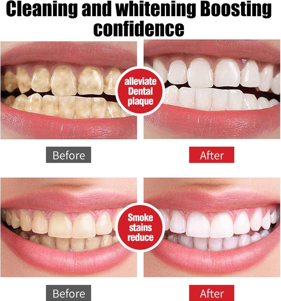 Pasta do zębów Sp7 Probiotic Whitening, Pasta do zębów Sp-7 Ultra Whitening, Pasta do zębów Sp 7, Pasta do zębów do usuwania plam i wybielania, Głębokie czyszczenie