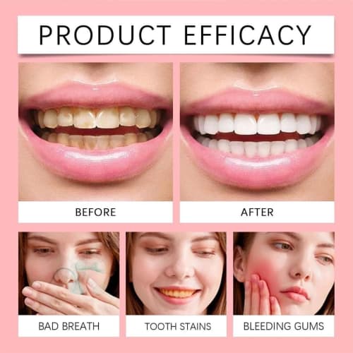 SP-10 Probiotic Toothpaste, Dental Probiotics Improve Oral Health and Whiten Teeth, Deep Cleaning Care Toothpaste, Fresh Breath, Reduce Teeth Stains(1