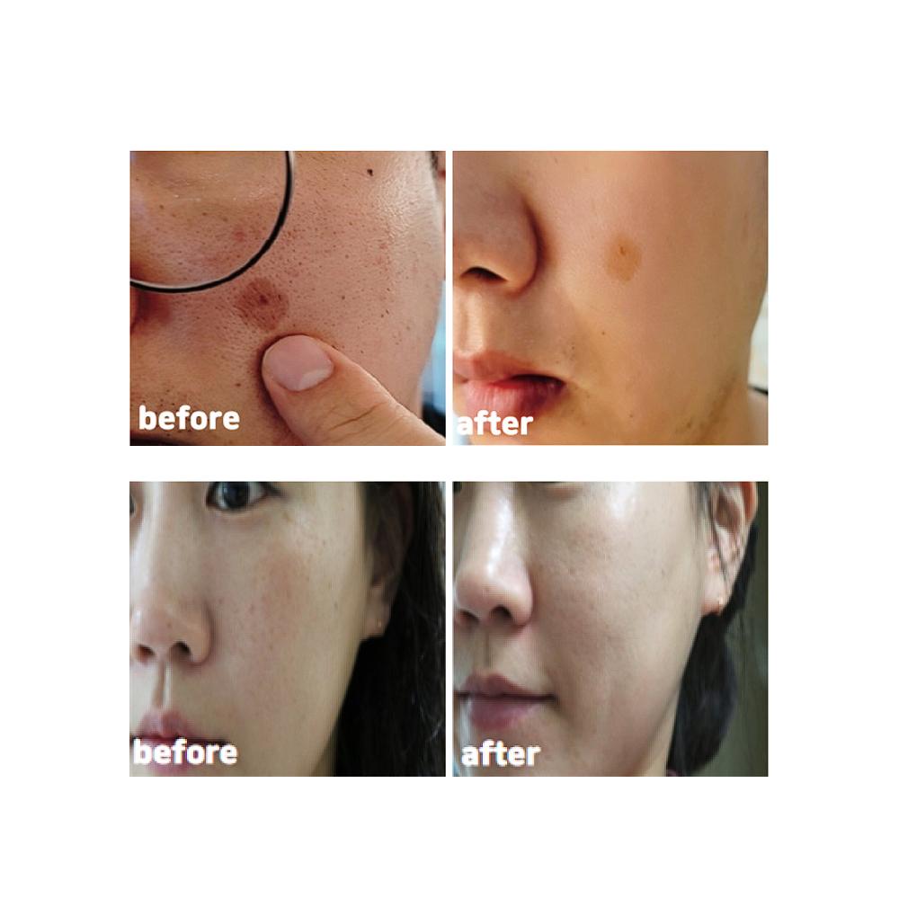 CELL HAPPY CO Dark Spot Solution Cream 50ml