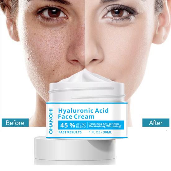 30ml Kyselina hyaluronová Pleťový krém Zpevňující pleť Zlepšuje elasticitu Přírodní extrakt Proti stárnutí Stahuje póry Krém proti vráskám pro ženy