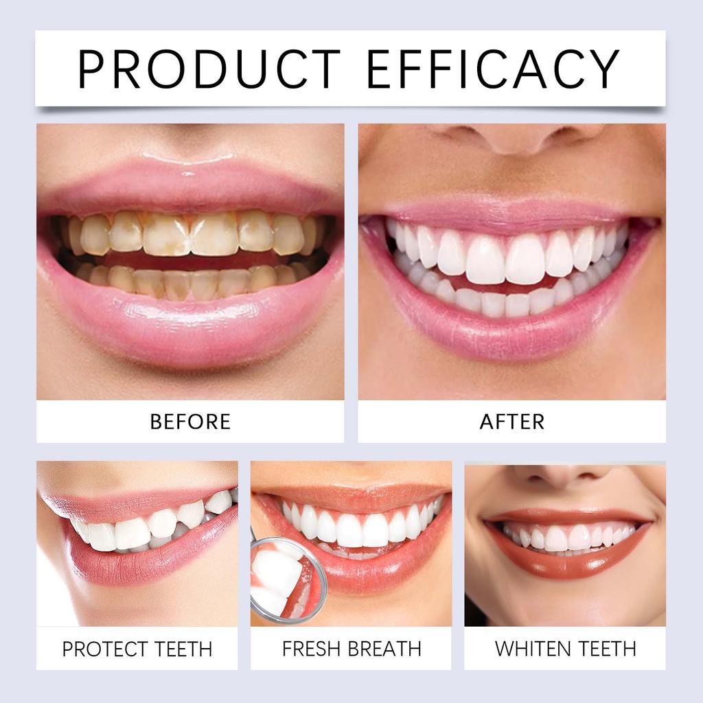 Oralhoe Pasta do zębów Care Delikatne czyszczenie Przebarwione zęby Żółty Kamień nazębny Zapach Pielęgnacja Pasta do zębów