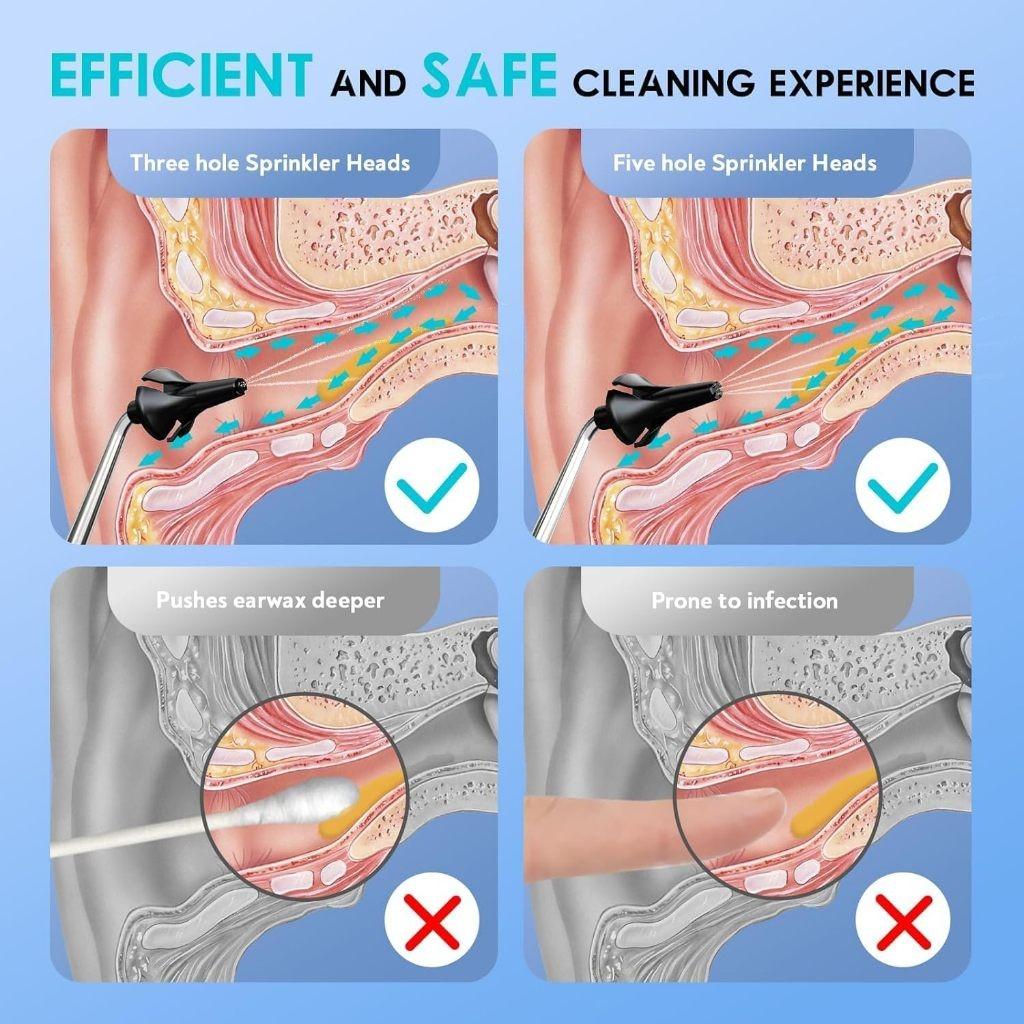 IPX7 Waterproof Ear Wax Removal Tool 9 Pressure Settings Water Powered Ear Cleaner Safe and Effective Ear Cleaning Kit