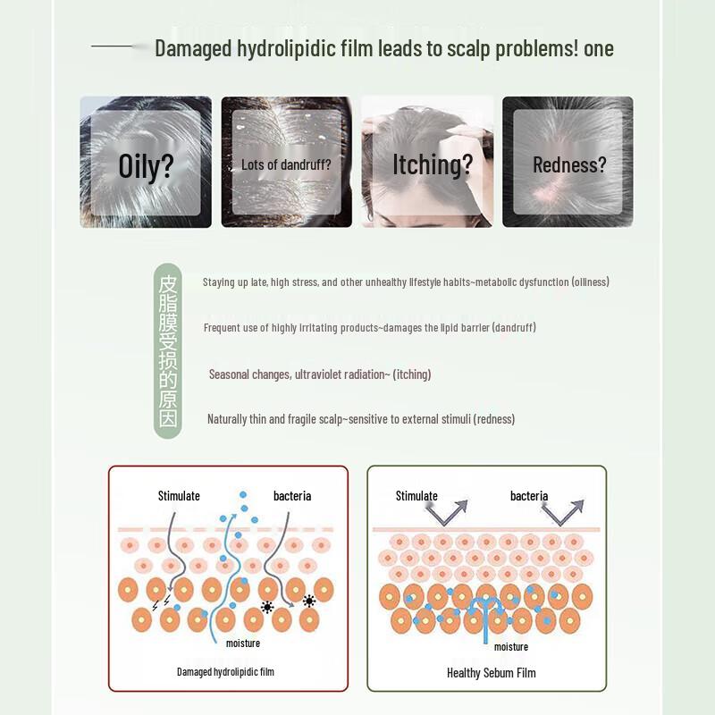 Shu Lei Anti-Dandruff & Oil Control Shampoo