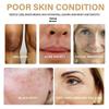 Turmeric Cream Dark Spot Corrector Skin Melasma Remove Wrinkles Serum Anti-Aging FT