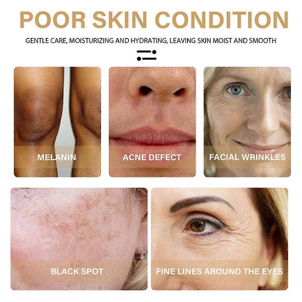 Turmeric Cream Dark Spot Corrector Skin Melasma Remove Wrinkles Serum Anti-Aging FT