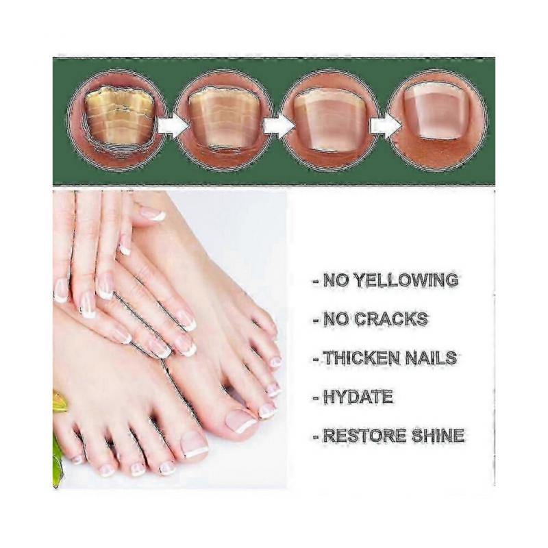 (2pcs)EELHOE Nail Repair Liquid Gray Nail Liquid Uneven Thick Nail Thickening Gray Nail Soft Nail Hand and Foot Repair Liquid