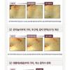 CENTELLIAN24 Expert Madeca Mela Capture Ampoule Max