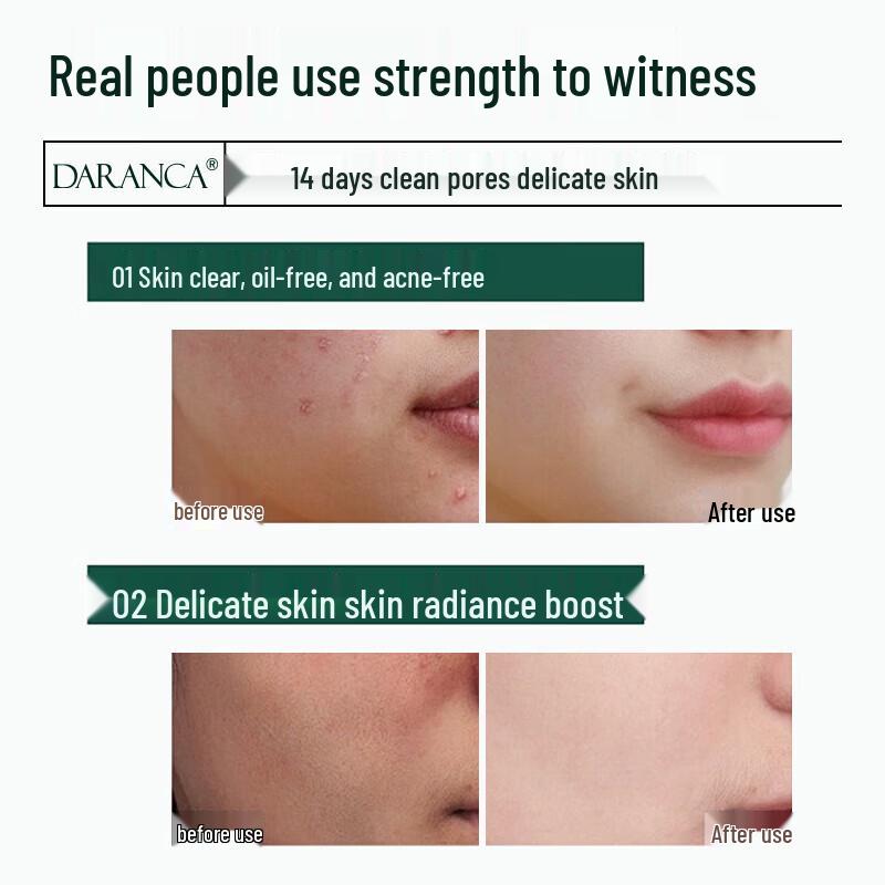 Tong Ren Tang Blackhead Peel-Off Mask 100g