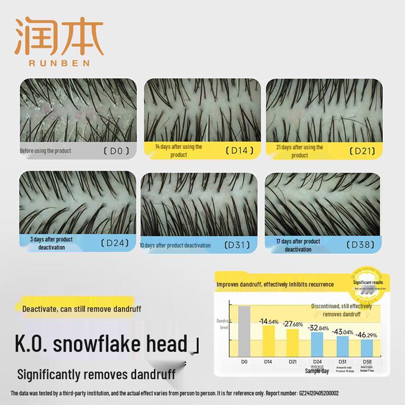 RUNBEN Teen Anti-Dandruff & Itch Relief Shampoo