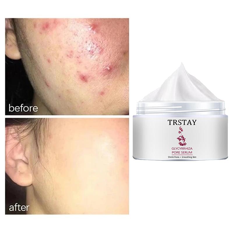 Translucent Cream, Gentle and Non-irritating, Smooths Wrinkles, Shrinks Pores, Fades Fine Lines, and Leaves Skin Soft and Delicate