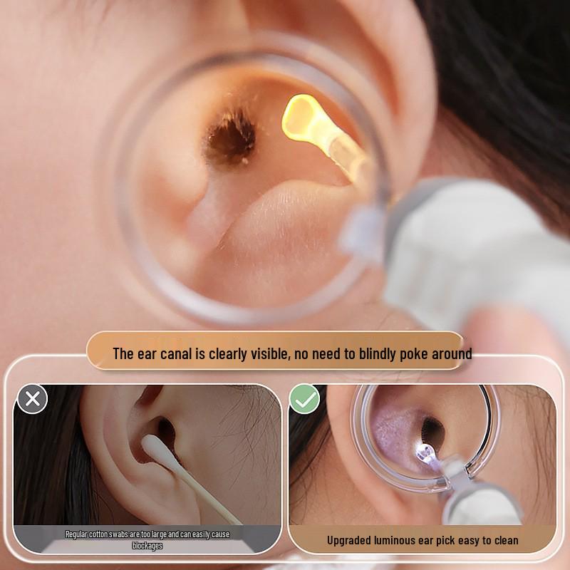Baby Earwax Removal Tool: Soft-Headed Ear Pick with Light for Infants and Toddlers