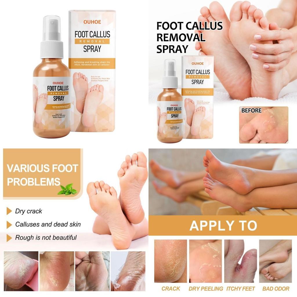 Nourishing Ouhoe Foot Spray For Softening Rough Skin And Removing Dead Skin Cells