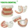 Modelo de Implante Dental 2 Implante Prótesis Completa Superior Inferior Modelo de Dientes Typodont Productos de Odontología Para Enseñanza Estudio