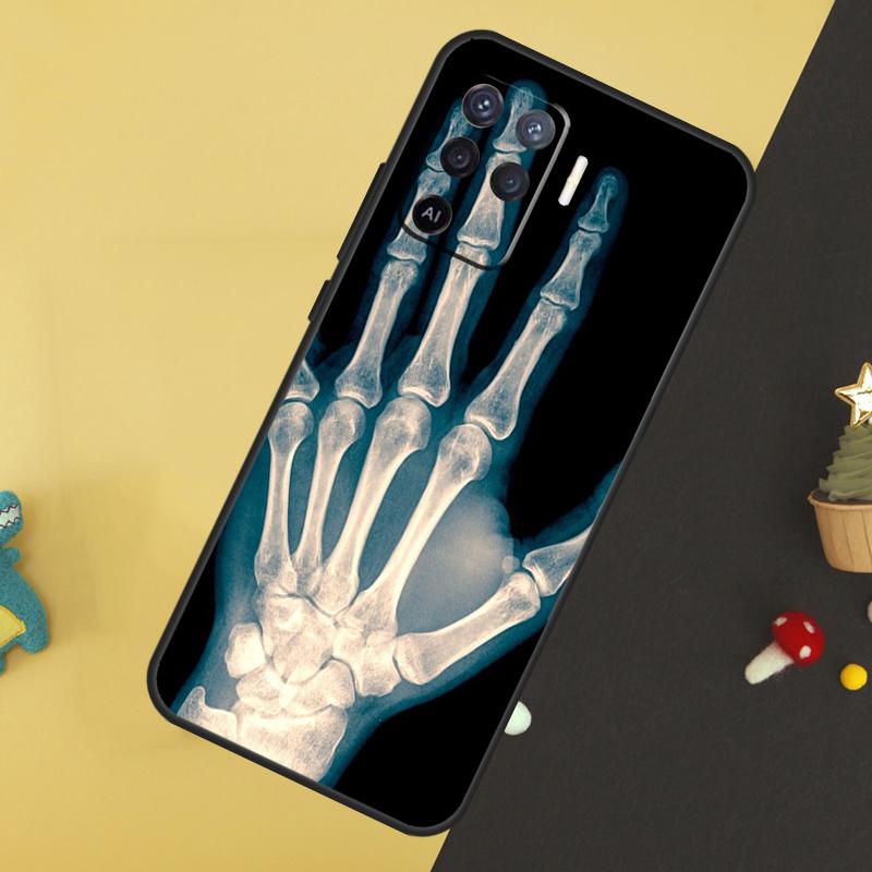 X-Ray Human Anatomy Case For Oppo A80 A60 A40 A54 A74 A94 A18 A38 A58 A78 A98 A96 A76 A16 A15 A17 A57 A5 A6 Pro