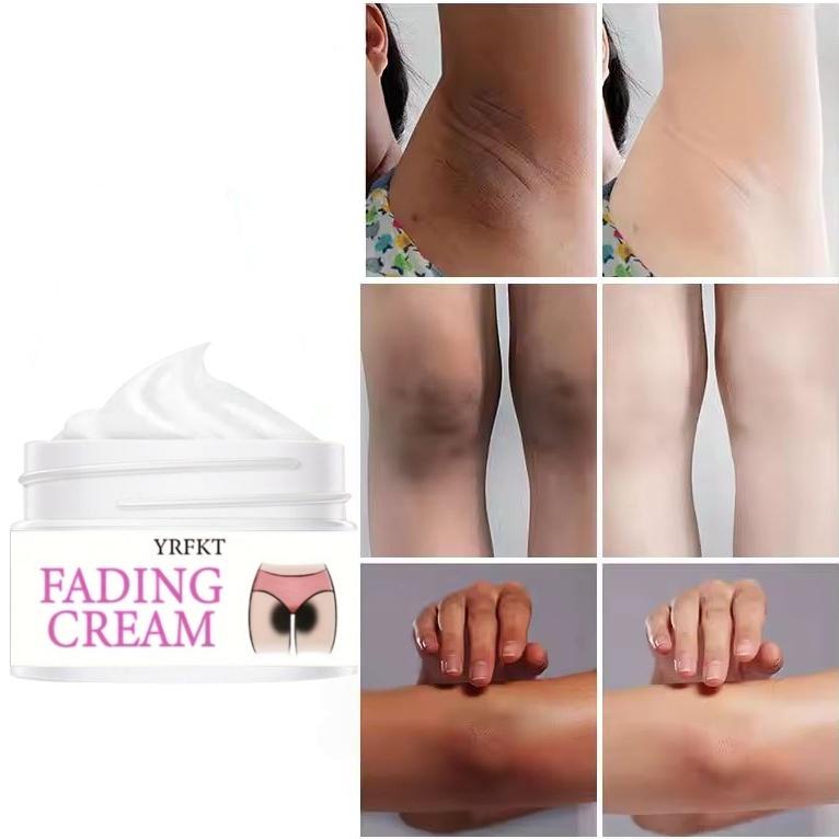 Vitamin E Moisturizing and Whitening Cream - Reduces Melanin, Brightens and Tightens the Skin, and Improves Dry and Peeling Skin