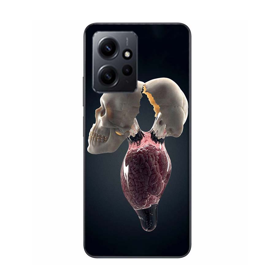 

The Cerebral Cortex And Key Components Phone Case For Redmi 12 13C 12C 15C 9 10 10C Note 13 Pro Plus 14 15 Pro 9T 9C 9A TPU Soft Redmi Note 11T Pro
