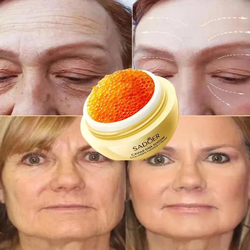 Caviar Anti-Falten-Gesichtscreme, Kollagen, Anti-Aging, straffendes Lifting, verblasst feine Linien, feuchtigkeitsspendend, glatt, aufhellend, Hautpflegeprodukte