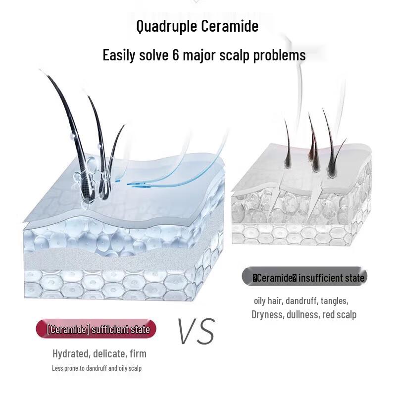 SURE Scalp Hydrating Anti-Dandruff Shampoo