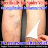 Gentle Varicose Veins Cream - All-Natural Herbs Relieves Venous Tension