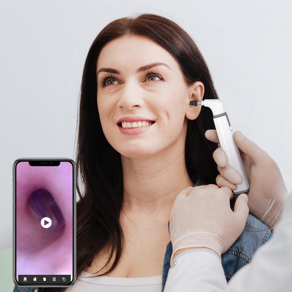 Teslong SA39W Xiaobai Portable HD WiFi Waterproof Ear Pick Otoscope