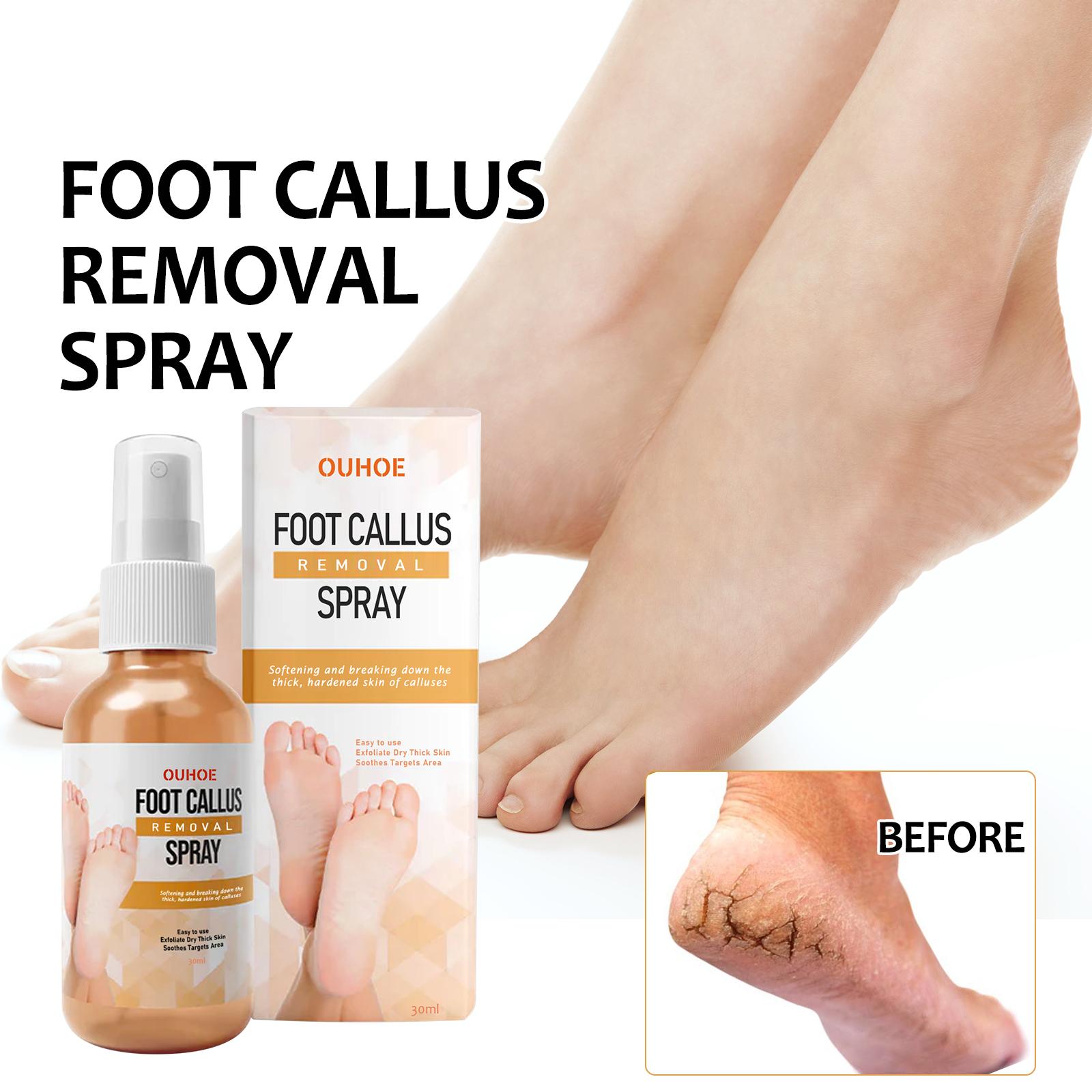 

OUHOE Foot Mist Exfoliating Anti-Dry Crack Repair Rough Skin Moisturizing Care Spray