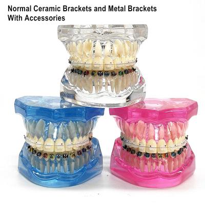 1 stuk Tandheelkundig Orthodontisch Model Patiëntcommunicatie 2 soorten Beugels met Archwires Ligaturen Keramische Beugel Metalen Edgewise Beugel