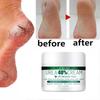Herbal Anti Crack Foot Cream Heel Cracking Repair Products Exfoliation Dead Skin Removal Softening Moisturize Smooth Skin Care