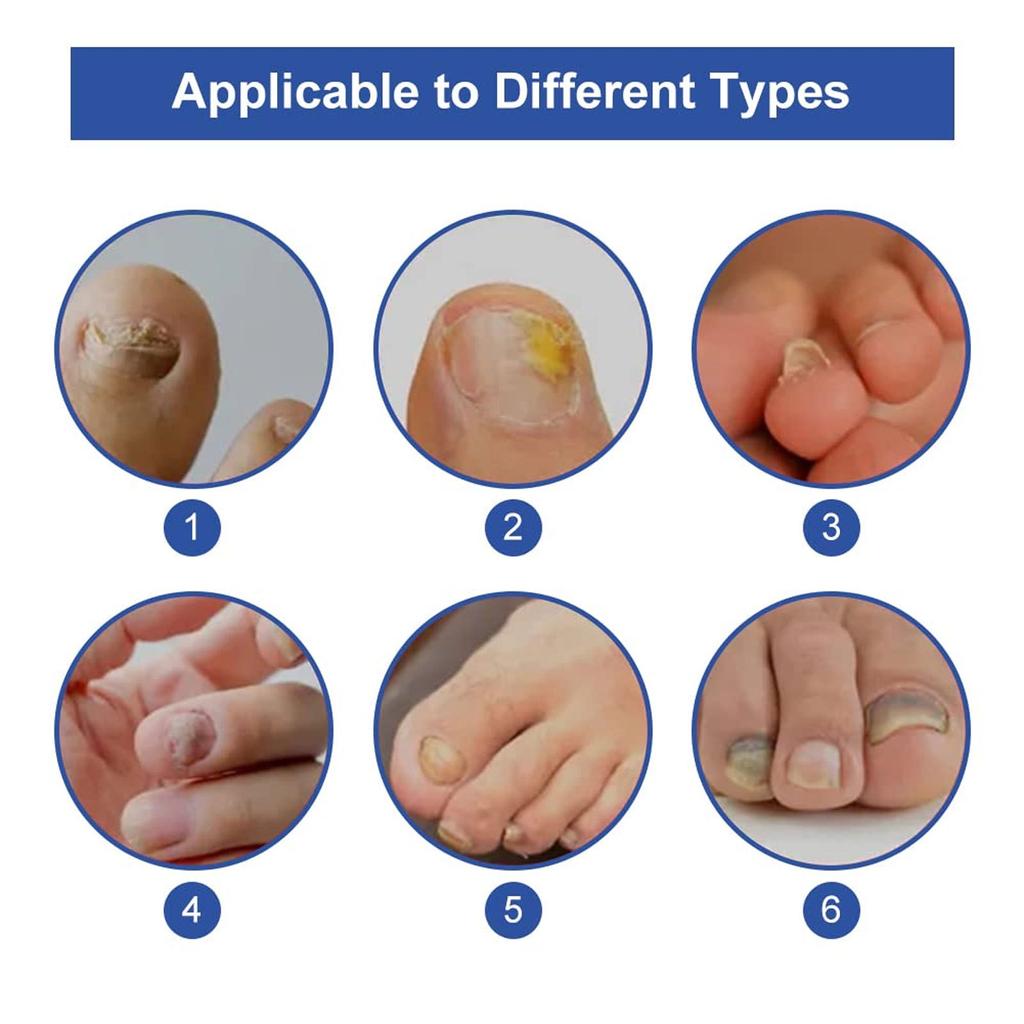 Liquid For Manicure Protects Hands And Toenails\30ml