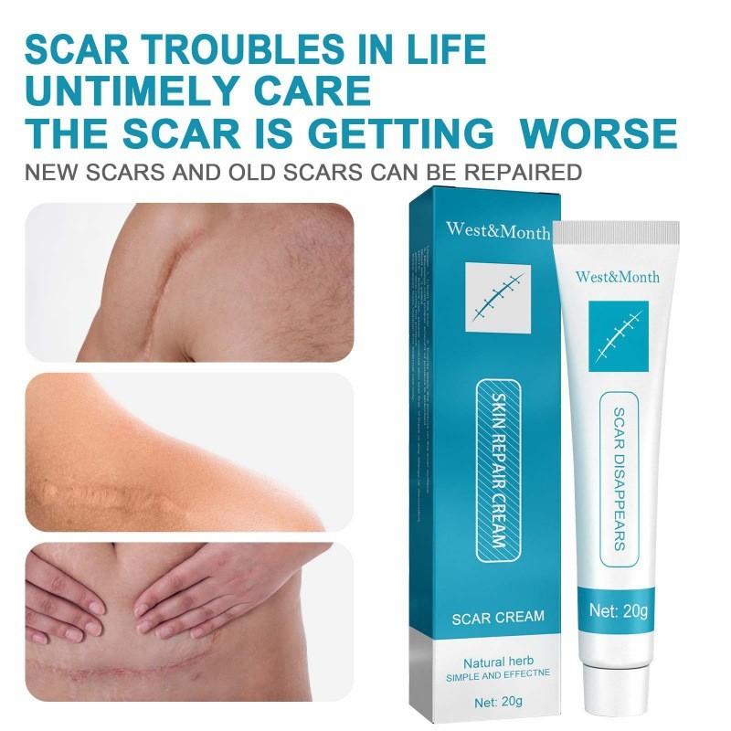 West Month Scar Repair Cream For Reducing Hypertrophic Scars And Pregnancy Marks