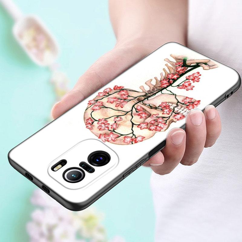 Arzt Krankenschwester Gesundheit Handyhülle Für Xiaomi POCO F2 F3 M2 M3 M4 X3 X4 Pro NFC F4 GT 5G F1 X2 C3 C31 C40 M5S Weiche TPU Schwarze Hülle