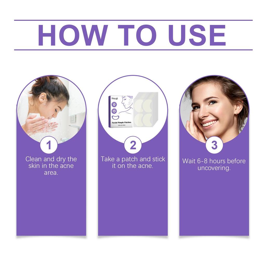 Hoygi Acne Patches Repair facial acne and blackheads Facial skin care acne concealing patches