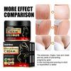 South Moon Scar Repair Cream Tightens Skin And Reduces Postpartum Scars