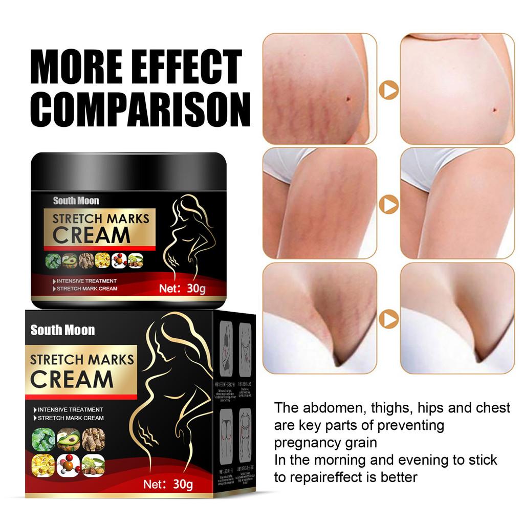 South Moon Scar Repair Cream Tightens Skin And Reduces Postpartum Scars