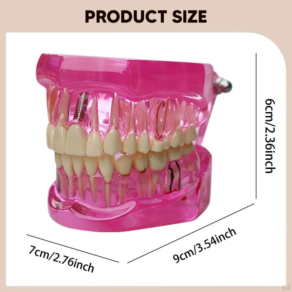Dental Demonstration Teeth Model Student Education Teaching Aid