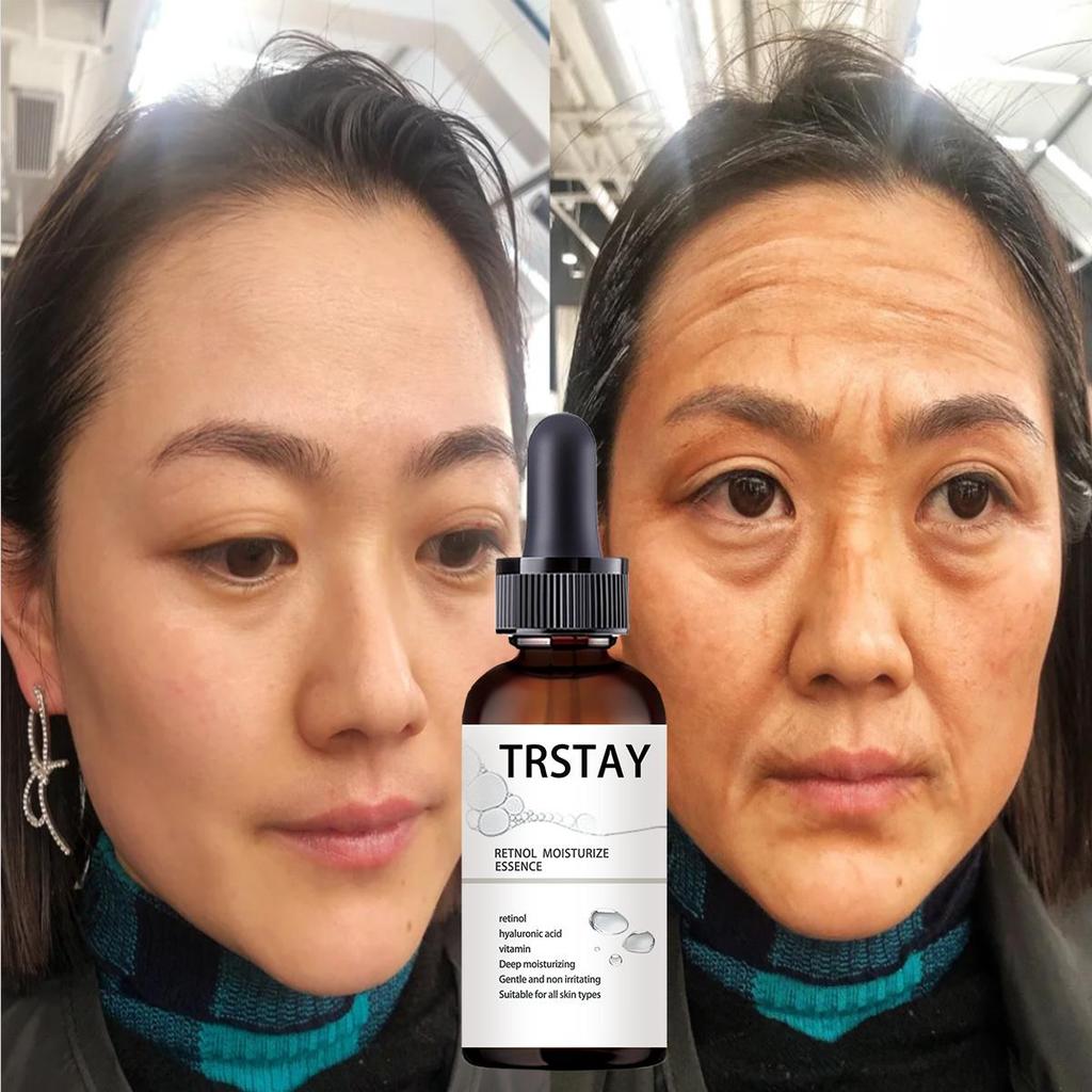 Retinol Moisturizing Face Cream Moisturizes and Nourishes To Reduce Wrinkles