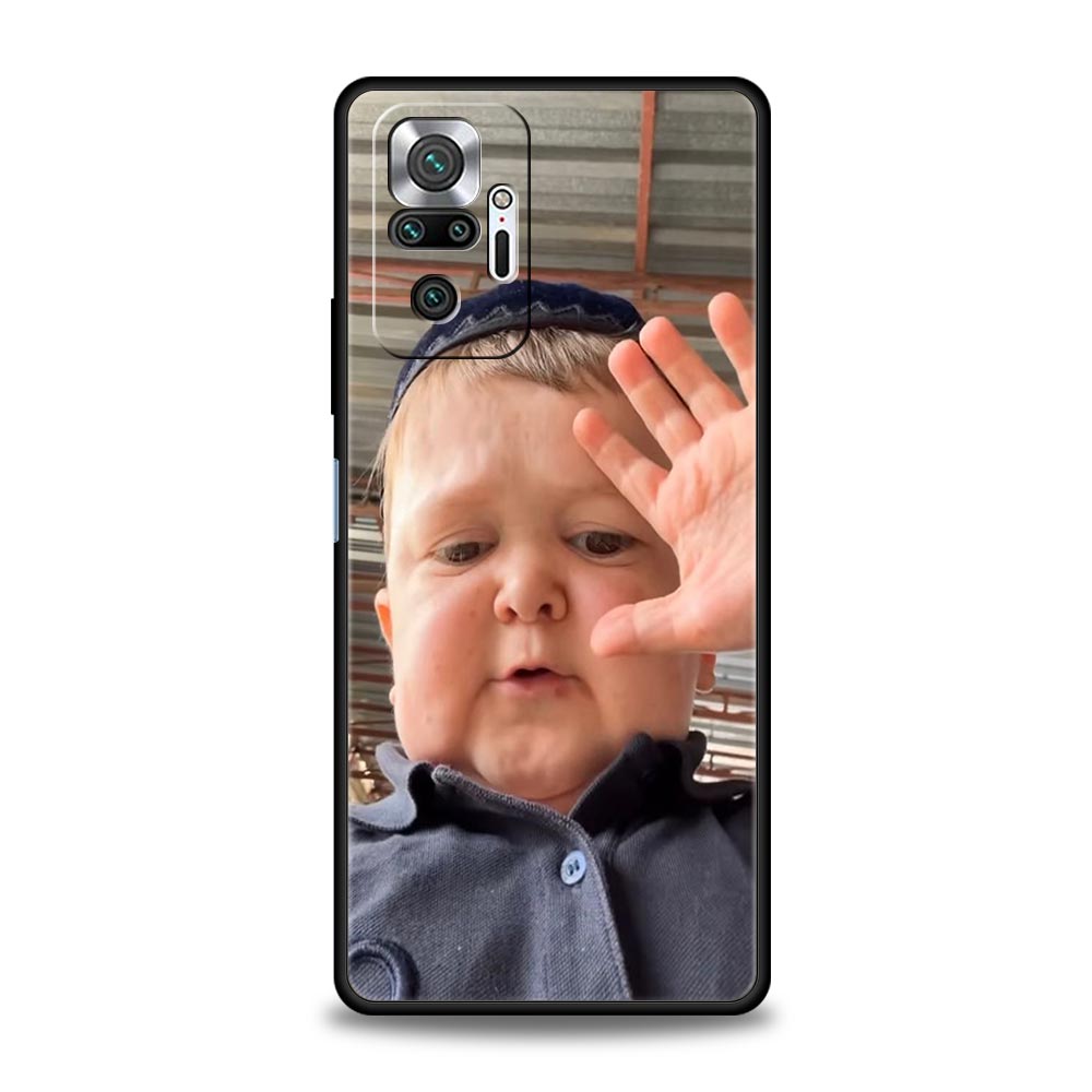 Funny Babaite Hasbulla Phone Case For Xiaomi Redmi Note 15 14 13 12 5G 11 10 Pro Plus 4G 9S 14C 13C 12C 10C Soft TPU Cover