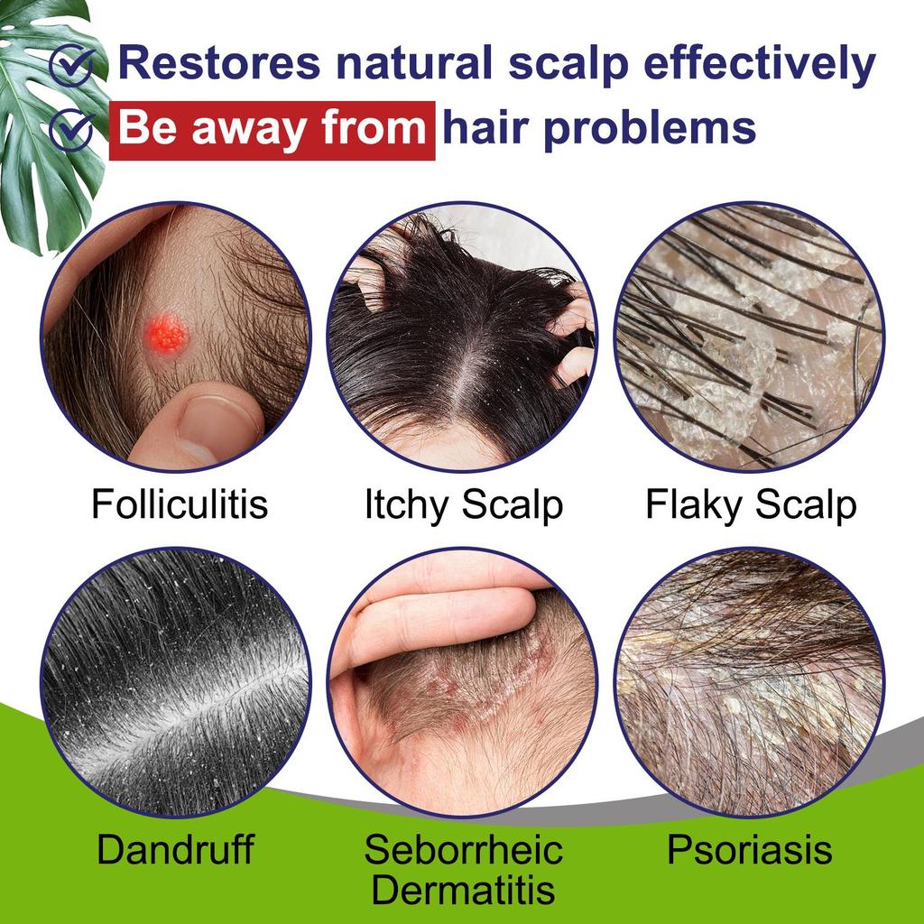 Pharmbanner Extra Stärke Follikulitis Shampoo-Beruhigt & Stellt die Kopfhaut wieder her-Heilt Haarfollikel-Geeignet für alle Haartypen, 300ml