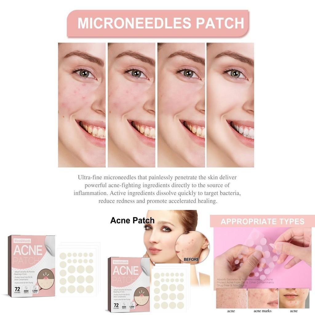West Month Acne Patch Gentle Repair Invisible Breathable Skin Smoothing 72pcs