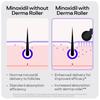 Sons Minoxidil 5% e Derma Roller, 3 Mesi