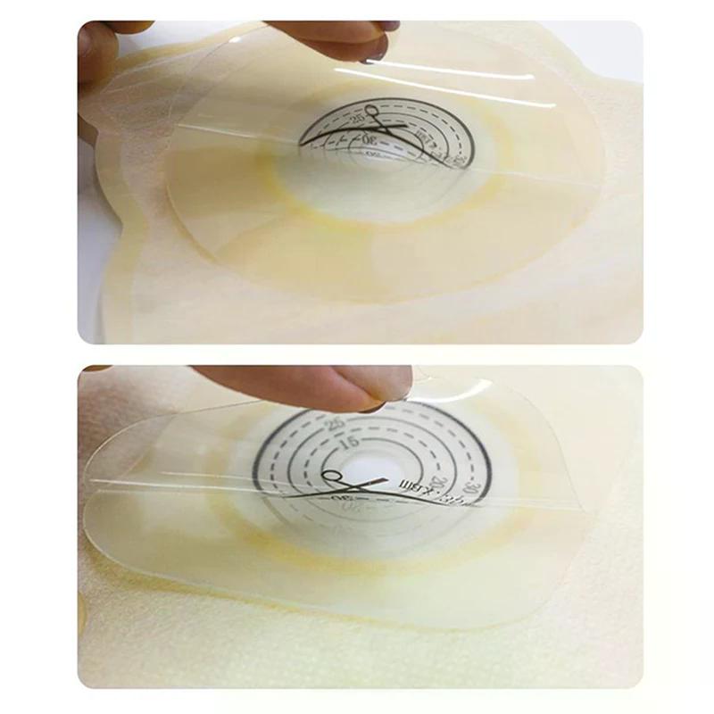 Children Ostomy Bags Drainable Pouches For Colostomy Ileostomy Stoma Care Drain Valve Prevent Leakage Hydrocolloid Colostomy Bag