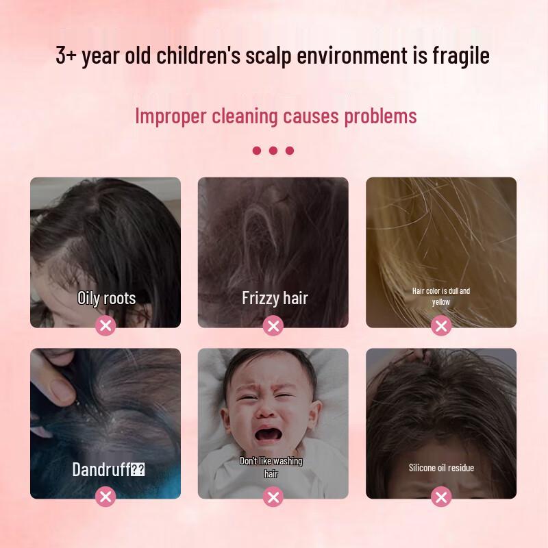Wuyang Teen & Kids Anti-Dandruff Oil Control Shampoo