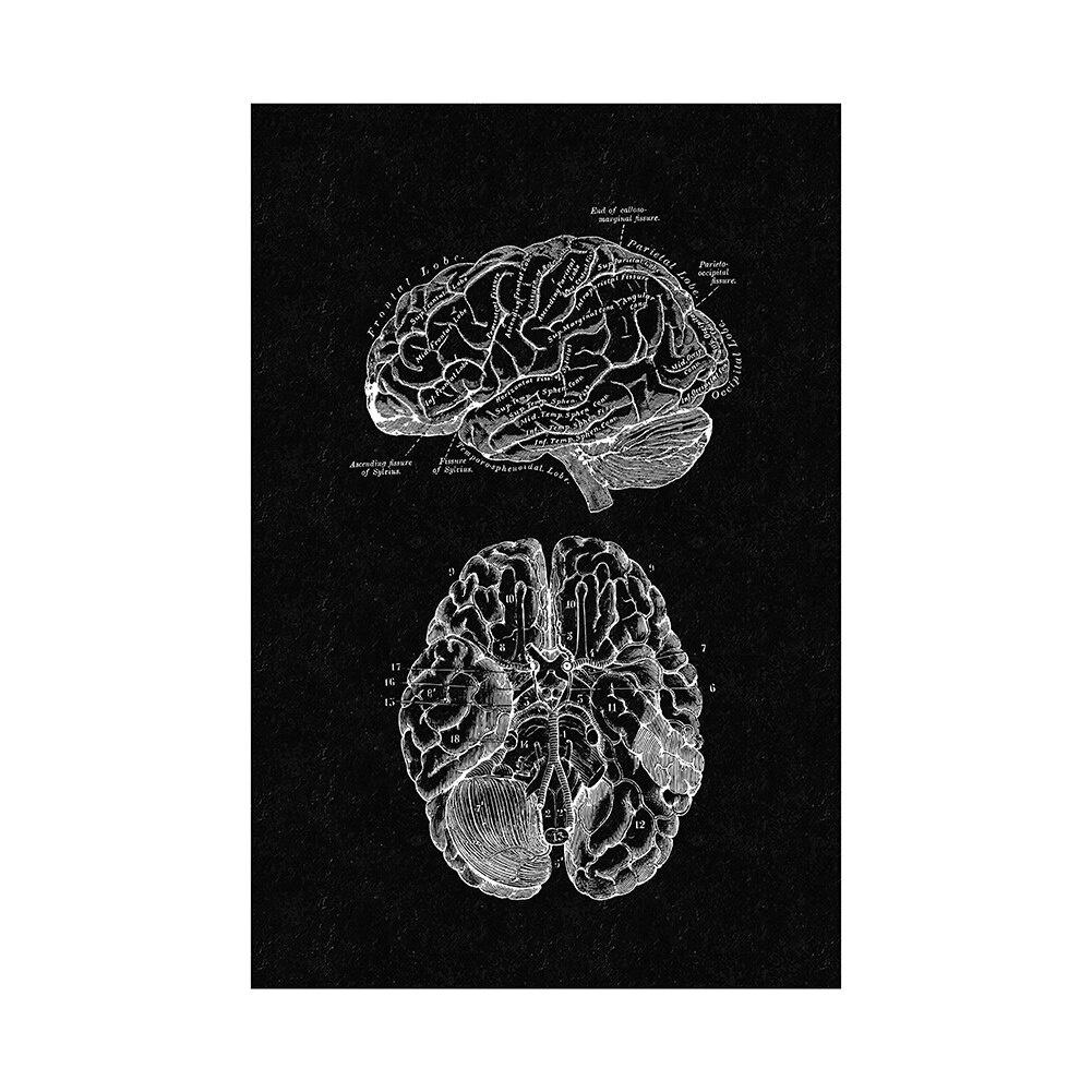 Canvas Printing Human Anatomy Artwork Wall Art Poster Skeleton Organ Muscular System Vintage Home Decor