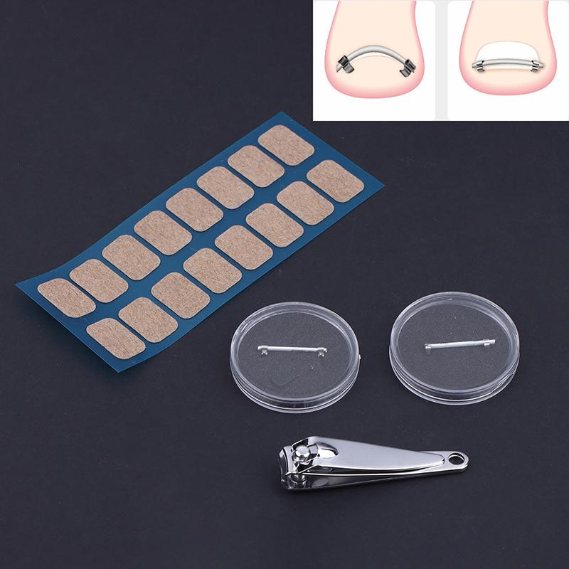 Toe Ingrown Pedicure Nail Buckle Toenails Corrector Foot Nail Correction Tool Straightening Clip Curved Brace Corrector